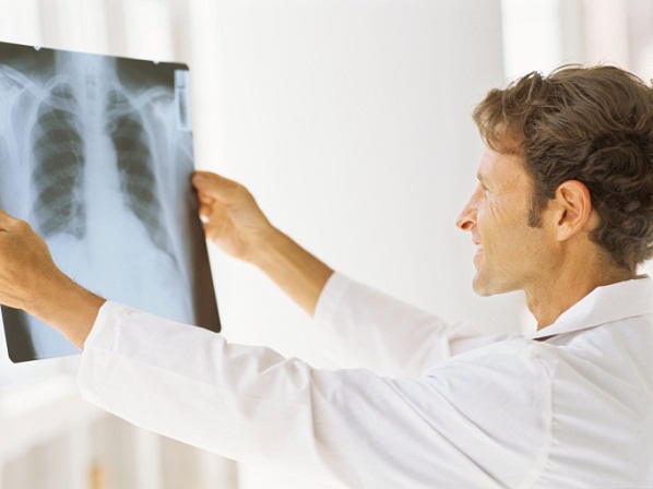 7  factores que desencadenan una embolia pulmonar - ¿Cómo se detecta la embolia pulmonar?